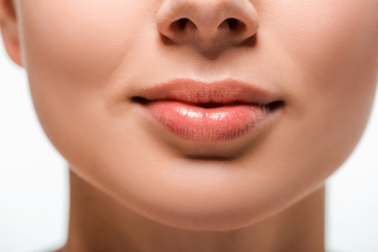 Services - Dermal Filler