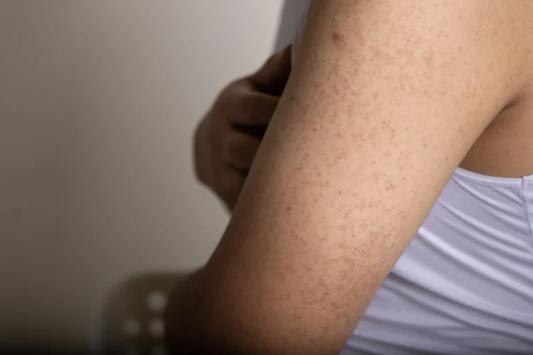 Services - Skin Lesion