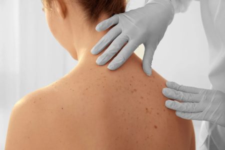 Services - Mohs Micrographic Surgery